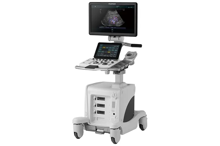 超音波画像診断装置